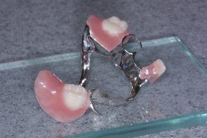 chrome denture