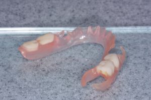 Flexi dentures